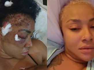 Angela Okorie Speaks Out After Being Shot In The Head By Assassins