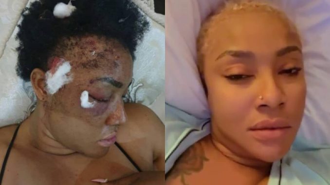 Angela Okorie Speaks Out After Being Shot In The Head By Assassins