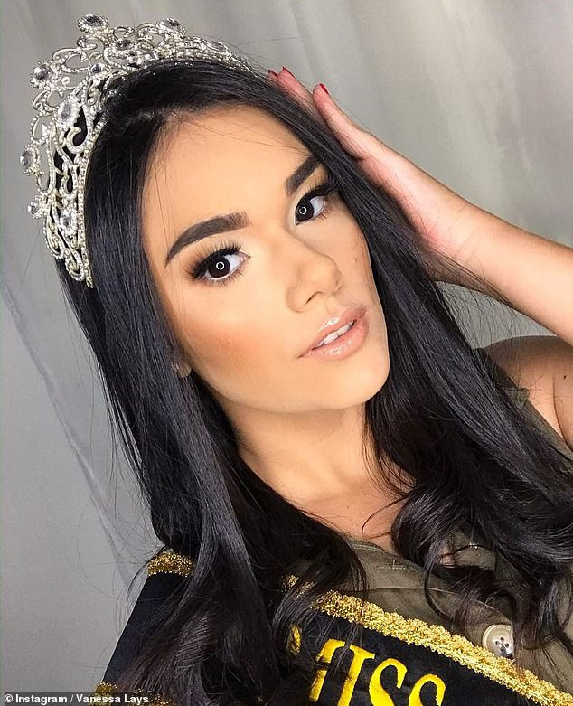 Brazilian beauty queen, 21, dies during surgery to remove a tumor near her liver
